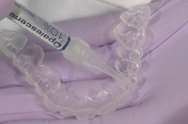 Opalescence tooth whitening